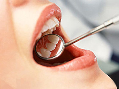 洗牙可以預防周牙疾病