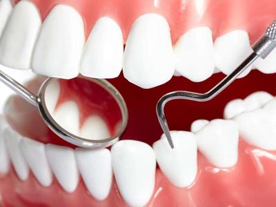 洗牙時牙齒酸痛的原因你造嗎？