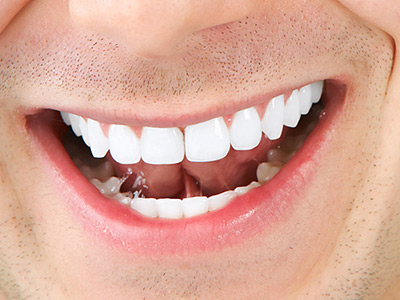 牙病也是慢性疾病 保護牙齒是一輩子的事
