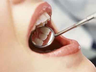 定期潔牙（洗牙）有益於口腔健康