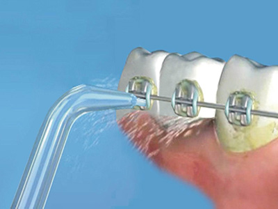 4種洗牙方式哪種最適合自己