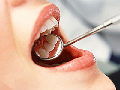 洗牙能使牙齒更健康 但護理兩大事項要留意