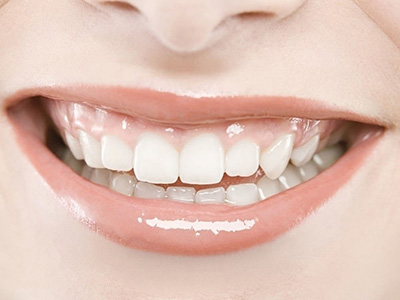 洗牙會對人的牙齒造成傷害嗎？