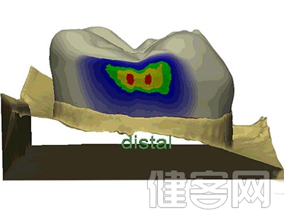 每天刷牙 還有必要使用「牙線」嗎？