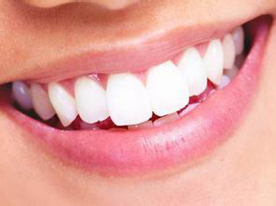 快來看你的牙齒距離“美白”還有多遠的路？