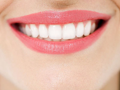 　牙齒美白五大誤區，你中招了嗎？