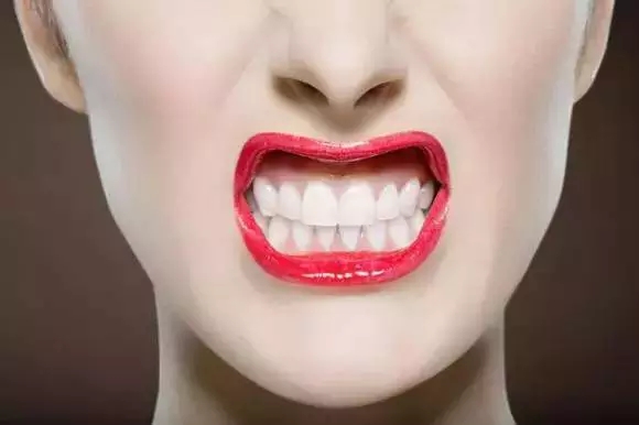 牙齒美白四大誤區，你誤入了嗎？