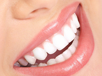 秋季正當時，你的牙齒美白了嗎？