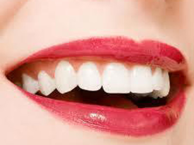 怎麼讓牙齒更白更亮？