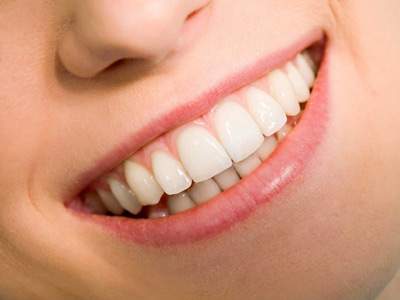 7大牙齒美白健康殺手 助您改善口腔健康