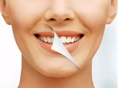 牙齒美白 八個方法讓牙齒自然靓白