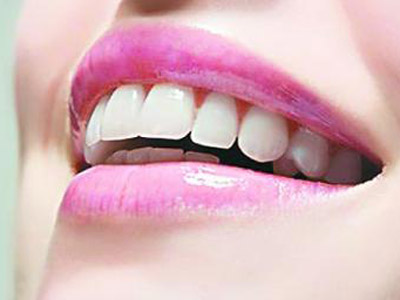 如何選擇適合自己的牙齒美白方式？