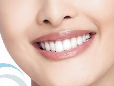 四環素牙、黃板牙應選用哪種美白方法？