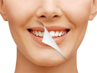 美白牙齒的四大優勢 美白前需要注意什麼
