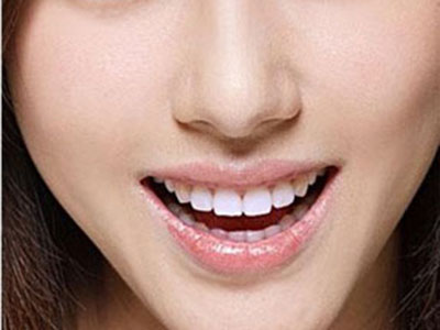 　對漂白劑美白牙齒的幾個錯誤認識