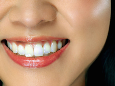 七大妙方讓你擁有健康潔白牙齒