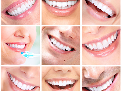 常見的牙齒美白方法有哪些