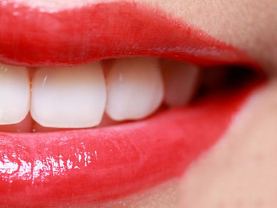 兩種牙齒美白劑聯合治療變色牙臨床效果分析