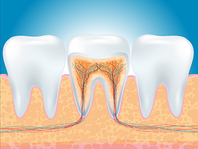牙齒美白的4個常見誤區