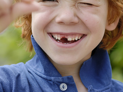 孩子新牙黃，警惕牙釉質發育不全！