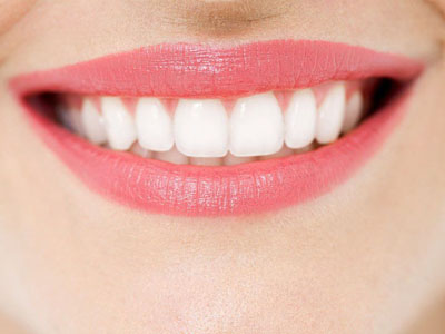 牙齒真的是越白越好嗎？