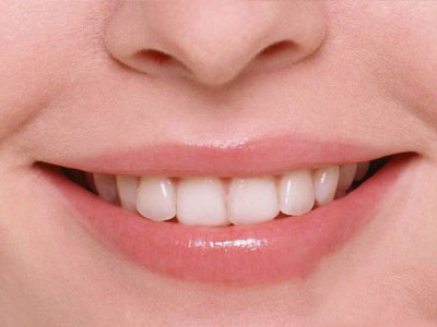 如何讓牙齒美白的持續時間更久