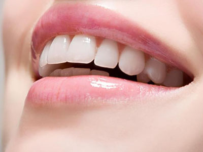 牙齒美白創可貼：牙貼面