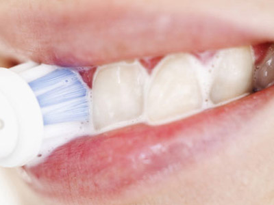 　　我們看到的牙齒顏色不僅是它表層的顏色，還包括透過表層牙釉質顯現出來的牙本質顏色。幼兒時乳牙是乳白色，隨著年齡的增長，整個身體機能老化，牙齒也會慢慢變色，其原因主要有兩種：外源性和內源性。  　　外源性：牙齒表面存在著多種細菌，它們分泌許多黏性物質。日常飲食如喝茶、飲咖啡，吸煙等都會在牙齒上留下色素，吸附在黏性物質上，使牙表面變黃、變黑。日積月累，這些污漬還會從表面逐漸深入內部，使牙齒內部也慢慢變色。  　　內源性：年齡增長會引起牙齒生理性變黃。此外還有三種情況：第一，<a name='InnerLinkKeyWord' href='http://www.jianke.com/yyzd/' _fcksavedurl='http://www.jianke.com/yyzd/' target='_blank'><a name='InnerLinkKeyWord' href='http://www.jianke.com/yyzd/' _fcksavedurl='http://www.jianke.com/yyzd/' target='_blank'>藥物</a></a>引起牙齒變黃、變黑，如四環素牙；第二，飲用水中含氟過多，會導致氟斑牙，牙面出現棕褐色斑塊；第三，如果牙神經壞死與細菌分解產物結合，牙齒就會壞死性變黑。  　　我國古代常用“皓齒”、“貝齒”、“瓠犀”等等來形容牙齒，無不取其白也。有詩雲：“貌美牙為先，齒白三分俏”。不僅中國古今都以牙齒潔白為美，國外也是如此。美國人對於白牙的熱愛由來已久，早在20世紀50年代，好萊塢就舉辦了“皓齒皇後”的評選活動，從而衍生了“好萊塢白”——“馬桶白”的牙審美時尚標准。  　　燦爛的笑容永遠比嘴角微微上翹來的親切、溫暖，明媚的笑容猶如沖透霧霾而來的一縷陽光，一出現便照亮了周圍的一切，它所帶來的感染性就像女人見到名牌手包一樣，見到它的人都會不由得被它吸引、影響。這是發自內心的感染力！然而對於平時抽煙、喝酒飲咖啡的男士來說，想要笑得燦爛並不是一件容易的事情，因此很有必要到專業的<a name='InnerLinkKeyWord' href='http://www.jianke.com/kqpd/yfhl/ycmb/' _fcksavedurl='http://www.jianke.com/kqpd/yfhl/ycmb/' target='_blank'><a name='InnerLinkKeyWord' href='http://www.jianke.com/kqpd/yfhl/ycmb/' _fcksavedurl='http://www.jianke.com/kqpd/yfhl/ycmb/' target='_blank'>牙齒美白</a></a>機構，給您<a name='InnerLinkKeyWord' href='http://www.jianke.com/zxpd/mlzx/mb/' _fcksavedurl='http://www.jianke.com/zxpd/mlzx/mb/' target='_blank'><a name='InnerLinkKeyWord' href='http://www.jianke.com/zxpd/mlzx/mb/' _fcksavedurl='http://www.jianke.com/zxpd/mlzx/mb/' target='_blank'>美白</a></a>建議與服務！