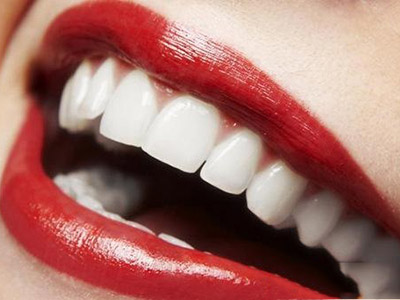 　　氟斑牙  　　氟斑牙主要是因為飲用水中氟含量過高所致。輕度者牙齒表面的牙釉質渾濁不透明，呈白垩色;中度者牙面呈黃色或棕黃色不規則形斑塊;重症者除有色澤改變外，還伴有牙面釉質缺損。冷光牙齒美白的獨特技術可以減輕氟斑牙帶來的的色素沉著現象，讓牙看起來更白更健康。  　　色素沉積  　　一些有色食物包括茶、咖啡、醬油以及香煙等，時間久了，由於沒有良好的清潔牙齒的習慣，這些色素會逐漸沉積甚至進入牙齒深層，使得牙齒的表面開始發黃、變黑。這就像白色的衣服長期被染色，如何清洗也無法使其恢復潔白一樣，一般的洗牙方法難以使染色後的牙齒再恢復原有的白色。  　　四環素牙  　　在牙齒<a name='InnerLinkKeyWord' href='http://www.jianke.com/yuer/yinger/szfy/' _fcksavedurl='http://www.jianke.com/yuer/yinger/szfy/' target='_blank'>發育</a>期間，特別是8歲以下兒童或孕婦，如果服用四環素類<a name='InnerLinkKeyWord' href='http://www.jianke.com/yyzd/' _fcksavedurl='http://www.jianke.com/yyzd/' target='_blank'>藥物</a>(如四環素、土霉素、強力霉素等)，則易引起牙齒變色，稱為四環素染色牙。這是因為四環素類藥物可與牙齒組織中的鈣離子結合形成穩定的四環素鈣鹽，隨年齡增長，變色會逐漸加重，約在18歲以後趨向穩定。  　　牙釉質發育不全  　　牙齒在發育過程中，表層的釉質因缺乏鈣、磷和維生素A、D等物質;或受有害因子的作用而造成的牙齒發育障礙。輕者牙齒表面的釉質呈不透明的白垩色，疏松粗糙，可因食物染色而呈黃褐色。重症者牙面釉質可出現實質性缺損，呈窩狀或帶狀缺損，甚至無釉質覆蓋。  　　齲齒、死髓牙  　　齲齒俗稱蟲牙或蛀牙，是由於在細菌的參與下，糖類食物酵解產酸而腐蝕牙體，久而久之造成牙齒變軟，牙組織崩解，形成黑色齲洞。而死髓牙多因深齲細菌感染或直接暴力打擊，牙齒意外折斷，導致牙髓損傷壞死而變色。