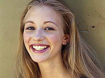 冷光美白三大優勢包含哪些