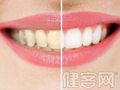 預防牙齒變黃的方法