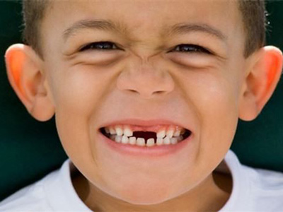 5歲女孩20顆牙壞了11顆 兒童口腔應該怎麼護理