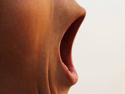 口臭會給患者造成哪些影響