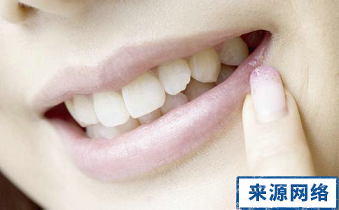 蛀牙會遺傳給孩子嗎 蛀牙會遺傳嗎 防治蛀牙有什麼方法