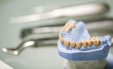 如何預防牙周炎 牙周炎的預防方法有哪些 怎麼預防牙周炎比較好