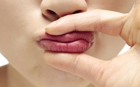 護理嘴唇干裂的方法 嘴唇干裂吃什麼 嘴唇干裂的怎麼保養