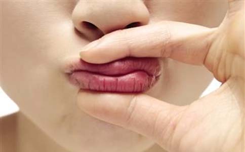 嘴唇干裂原因有哪些 嘴唇干裂治療方法是什麼 嘴唇干裂如何改善