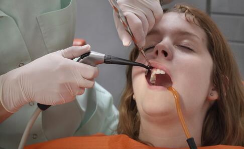 拔牙後注意事項 拔牙後如何飲食 拔牙後注意什麼