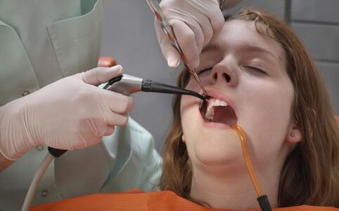 拔牙後的護理方法 拔牙後如何護理 拔牙後注意事項