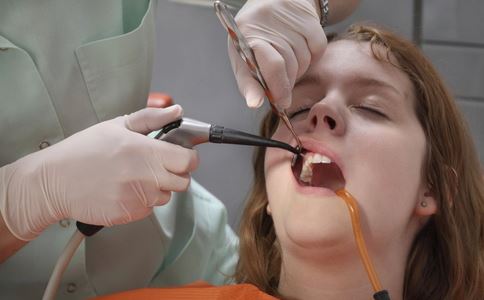 補牙要注意什麼 補牙後有什麼注意事項 補牙後牙痛是什麼原因
