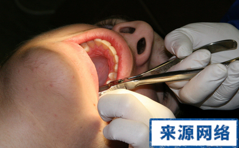補牙後要注意什麼 補牙後護理 補牙後護理措施
