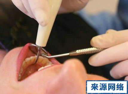 補牙能用多久 補牙要多久 補牙使用時間