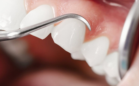 什麼牙齒最適合做烤瓷牙 烤瓷牙適合哪種牙齒 如何分辨烤瓷牙的好壞